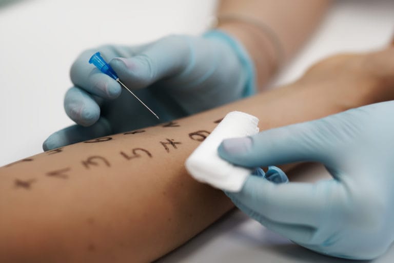 Skórne Testy Alergiczne Najczęściej Przeprowadza Się W Następujący Sposób Testy alergiczne - skórne testy punktowe - Sublimed