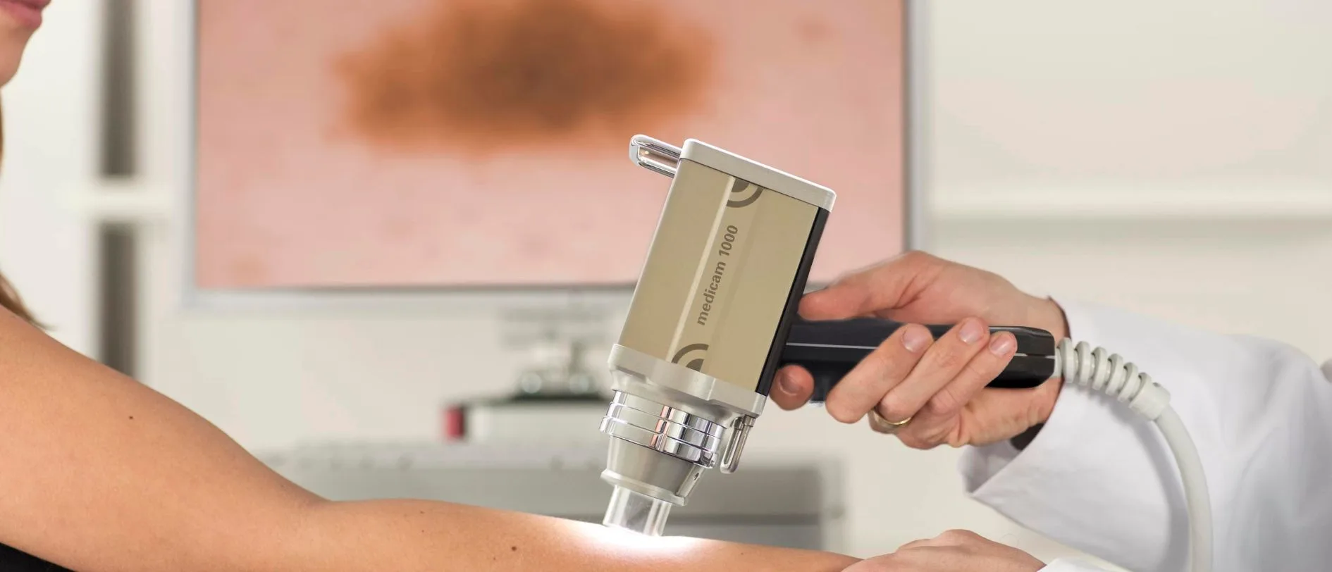 dermatoskopia